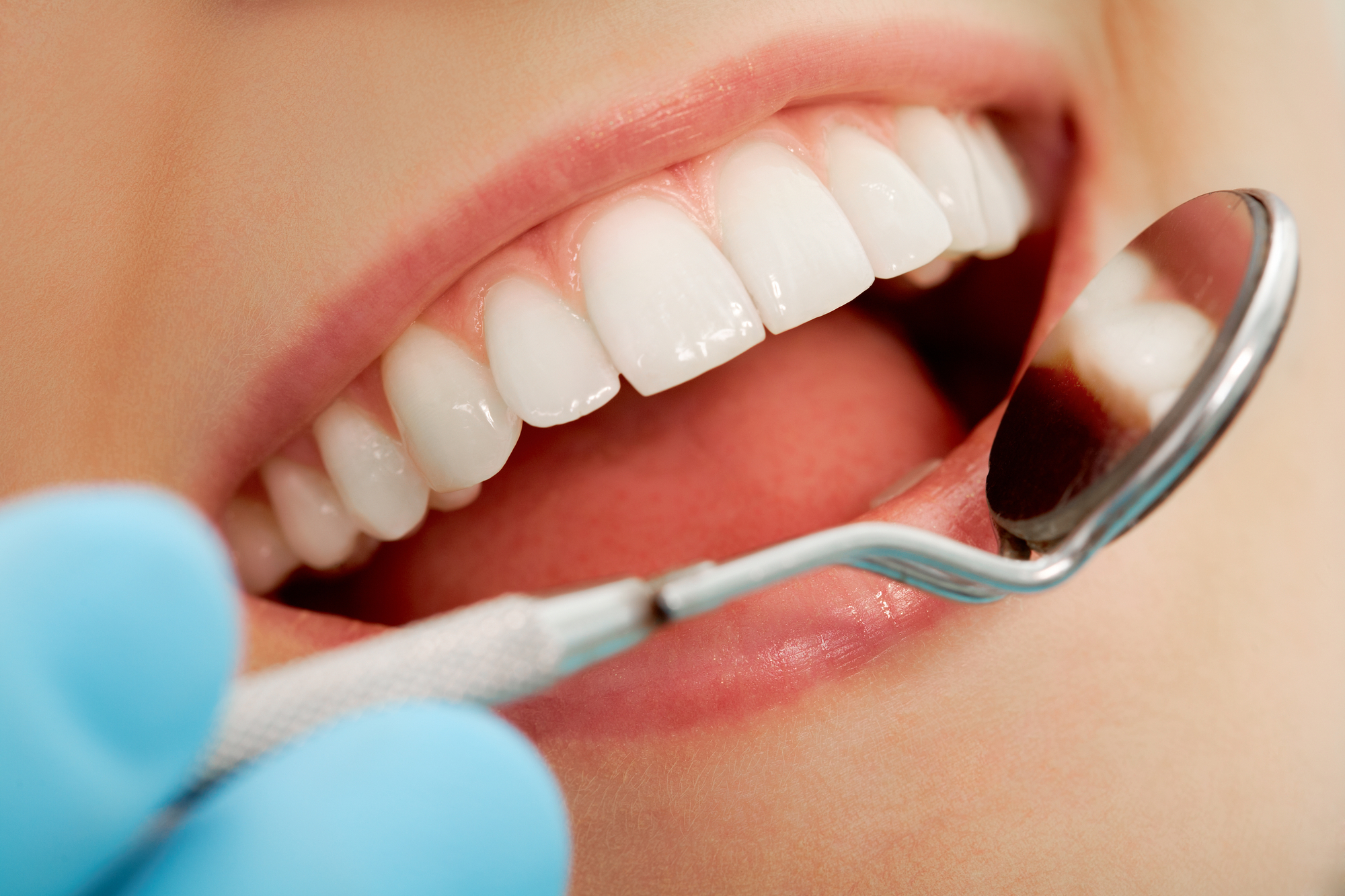 cosmetic dentistry in Cronulla