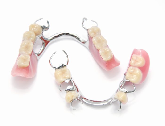 Metal Partial Denture
