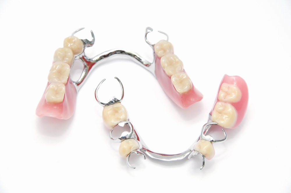 Metal Partial Denture
